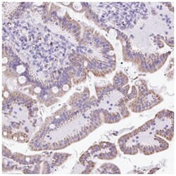 Cytokeratin 12 Antibody, Novus Biologicals:Antibodies:Primary Antibodies