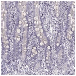 Cytokeratin 26 Antibody, Novus Biologicals 100&mu;L; Unlabeled:Antibodies,