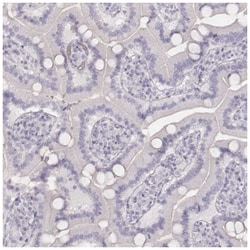 Cytokeratin 72 Antibody, Novus Biologicals 100&mu;L; Unlabeled:Antibodies,