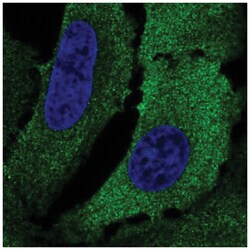 Cytokeratin 75 Antibody, Novus Biologicals 100&mu;L; Unlabeled:Antibodies,