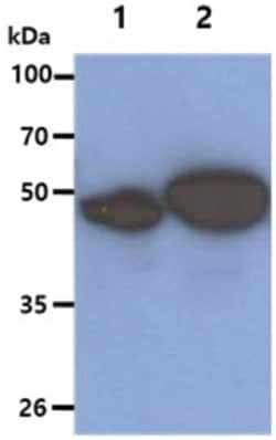 Cytokeratin 5 Mouse anti-Human, Clone: 12C4, Novus Biologicals:Antibodies:Primary