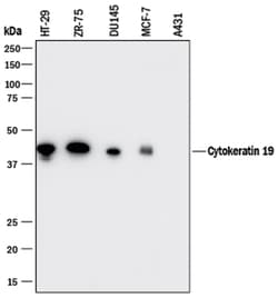 Human Cytokeratin 19 Antibody, R D Systems:Antibodies:Primary Antibodies