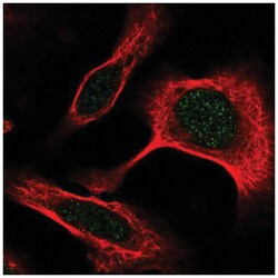 DAPK3/ZIPK Antibody, Novus Biologicals 100&mu;L; Unlabeled:Antibodies,
