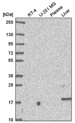 DC2 Antibody, Novus Biologicals 100 &mu;L | Buy Online | Novus Biologicals | Fisher Scientific