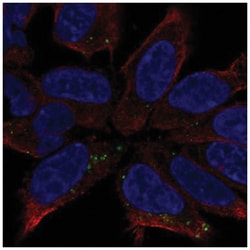 DCC Antibody, Novus Biologicals 25 &mu;L, Unlabeled:Antibodies, Polyclonal