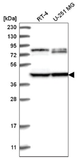 DCDC2 Antibody, Novus Biologicals:Antibodies:Primary Antibodies