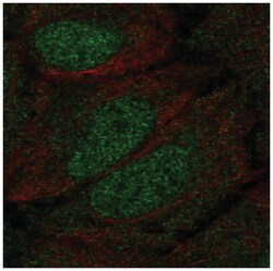 DCLK1 Antibody, Novus Biologicals 25 &mu;L, Unlabeled:Antibodies, Polyclonal