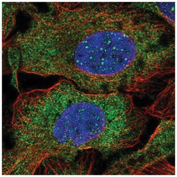 DCP1B Antibody, Novus Biologicals 100 &mu;L | Buy Online | Novus Biologicals | Fisher Scientific