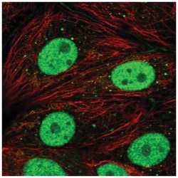 DCP2 Antibody, Novus Biologicals 25 &mu;L, Unlabeled:Antibodies, Polyclonal