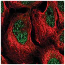 DCPS Antibody, Novus Biologicals:Antibodies:Primary Antibodies