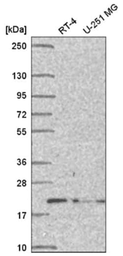 DCTN5 Antibody, Novus Biologicals 100&mu;L; Unlabeled:Antibodies, Polyclonal