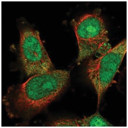 DDA1 Antibody, Novus Biologicals 100&mu;L; Unlabeled:Antibodies, Polyclonal