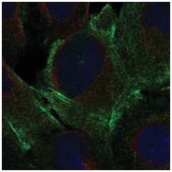 DDR2 Antibody, Novus Biologicals:Antibodies:Primary Antibodies