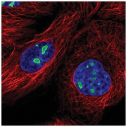 DDX18 Antibody, Novus Biologicals 100 &mu;L | Buy Online | Novus Biologicals | Fisher Scientific