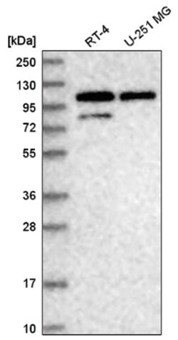 DDX23 Antibody, Novus Biologicals 100&mu;L; Unlabeled:Antibodies, Polyclonal