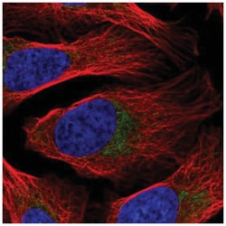 DDX28 Antibody, Novus Biologicals 25 &mu;L, Unlabeled:Antibodies, Polyclonal