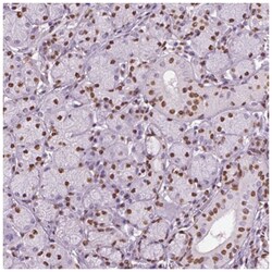 DDX3 Antibody, Novus Biologicals:Antibodies:Primary Antibodies