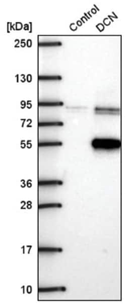 Decorin Antibody, Novus Biologicals:Antibodies:Primary Antibodies