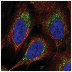 DEGS1 Antibody, Novus Biologicals 25 &mu;L, Unlabeled:Antibodies, Polyclonal