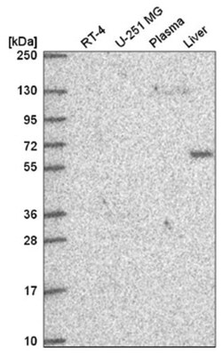 DEPDC1B Antibody, Novus Biologicals 100&mu;L; Unlabeled:Antibodies, Polyclonal