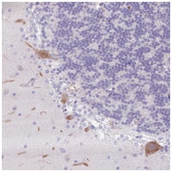 Dermcidin Antibody, Novus Biologicals 25 &mu;L | Buy Online | Novus Biologicals | Fisher Scientific