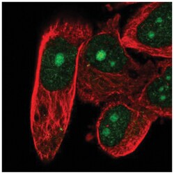 DFF40/CAD Antibody, Novus Biologicals 100&mu;L; Unlabeled:Antibodies, Polyclonal