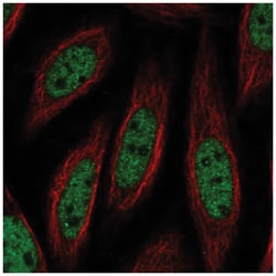 DGCR2 Antibody, Novus Biologicals 100&mu;L; Unlabeled:Antibodies, Polyclonal