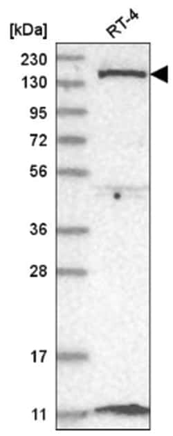 DGK-delta Antibody, Novus Biologicals 100 &mu;L | Buy Online | Novus Biologicals | Fisher Scientific