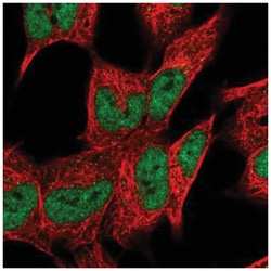 DHRS12 Antibody, Novus Biologicals 100&mu;L; Unlabeled:Antibodies, Polyclonal