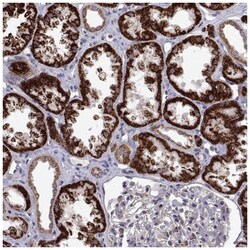 DHTKD1 Antibody, Novus Biologicals 25 &mu;L, Unlabeled:Antibodies, Polyclonal
