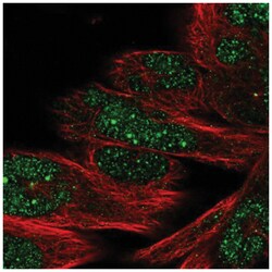 DHX35 Antibody, Novus Biologicals 25 &mu;L, Unlabeled:Antibodies, Polyclonal