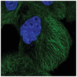 DIAPH3 Antibody, Novus Biologicals 25 &mu;L, Unlabeled:Antibodies, Polyclonal