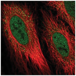 DIO2 Antibody, Novus Biologicals 100&mu;L; Unlabeled:Antibodies, Polyclonal
