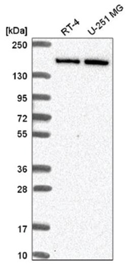 DIP2C Antibody, Novus Biologicals:Antibodies:Primary Antibodies