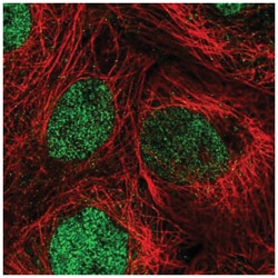 DIS3 Antibody, Novus Biologicals:Antibodies:Primary Antibodies