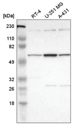 DKC1 Antibody, Novus Biologicals 25 &mu;L:Antibodies, Polyclonal