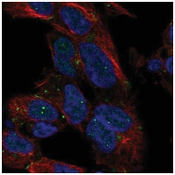 Dlx1 Antibody, Novus Biologicals 100 &mu;L | Buy Online | Novus Biologicals | Fisher Scientific