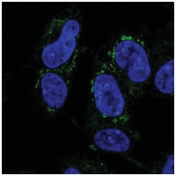 DMRTA2 Antibody, Novus Biologicals 100&mu;L; Unlabeled:Antibodies, Polyclonal