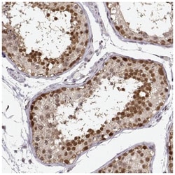 DNA Polymerase iota Antibody, Novus Biologicals 100&mu;L; Unlabeled:Antibodies,