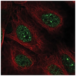 DNA Polymerase Kappa Antibody, Novus Biologicals 25 &mu;L, Unlabeled:Antibodies,