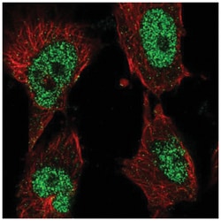 DNA Polymerase Kappa Antibody, Novus Biologicals:Antibodies:Primary Antibodies