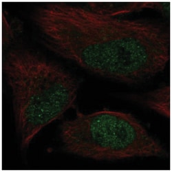 DNA Polymerase Kappa Antibody, Novus Biologicals:Antibodies:Primary Antibodies