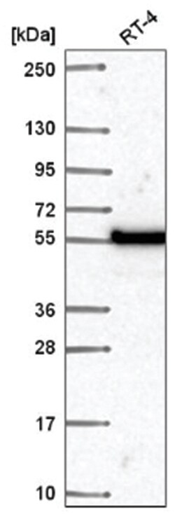 DNA polymerase mu Antibody, Novus Biologicals 100&mu;L; Unlabeled:Antikörper