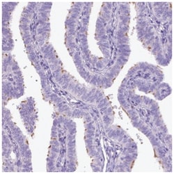 DNAH11 Antibody, Novus Biologicals 100&mu;L; Unlabeled:Antibodies, Polyclonal