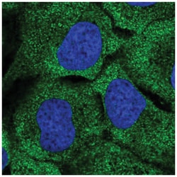 DNAH7 Antibody, Novus Biologicals 100 &mu;L | Buy Online | Novus Biologicals | Fisher Scientific