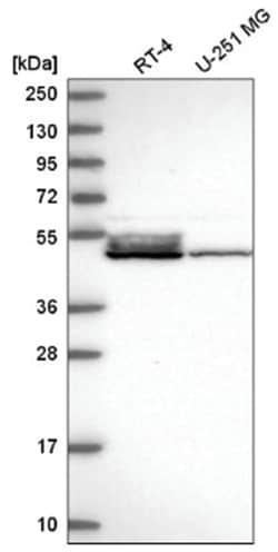 DNAJA4 Antibody, Novus Biologicals 25 &mu;L; Unlabeled:Antibodies, Polyclonal