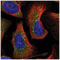 DNAJC21 Antibody, Novus Biologicals 100&mu;L; Unlabeled:Antibodies, Polyclonal