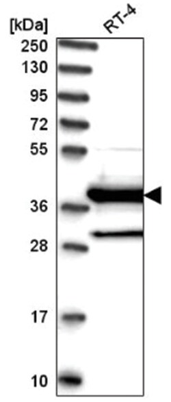 DNAJC22 Antibody, Novus Biologicals:Antibodies:Primary Antibodies