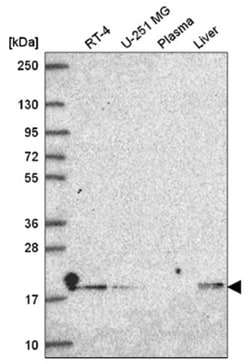 DNLZ Antibody, Novus Biologicals 100&mu;L; Unlabeled:Antibodies, Polyclonal