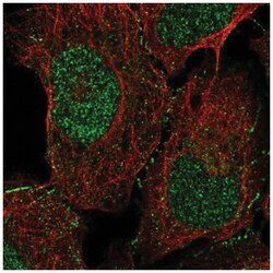 Doc2-alpha Antibody, Novus Biologicals 25 &mu;L:Antibodies, Polyclonal